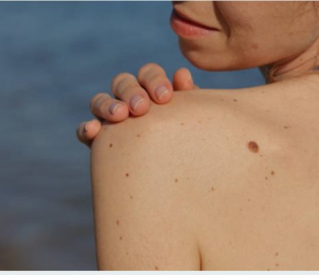 Be467d83 5ad8 40f1 9418 F672e04339c9